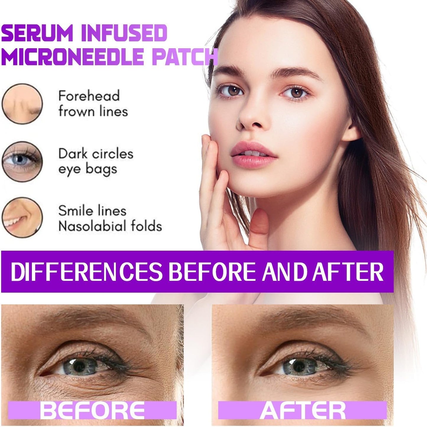 LOVILDS microneedle patch