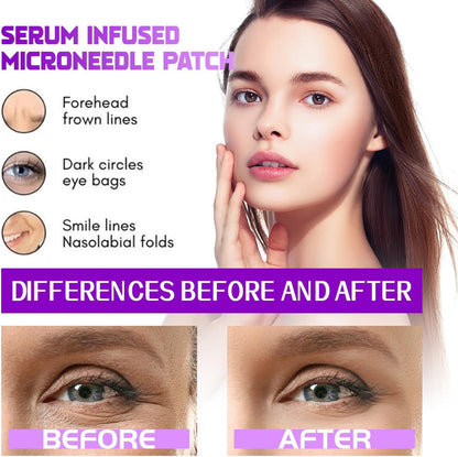 LOVILDS microneedle patch