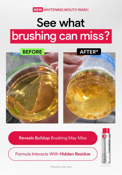 Hismile iD Whitening Mouthwash – See Visible Stain Removal & Instant Fresh Breath