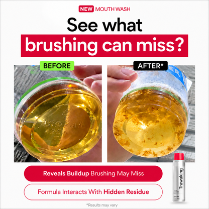 Deep-Cleanse Liquid Oral Rinse – Watch Visible Impurities Flush Away for a Healthier Smile